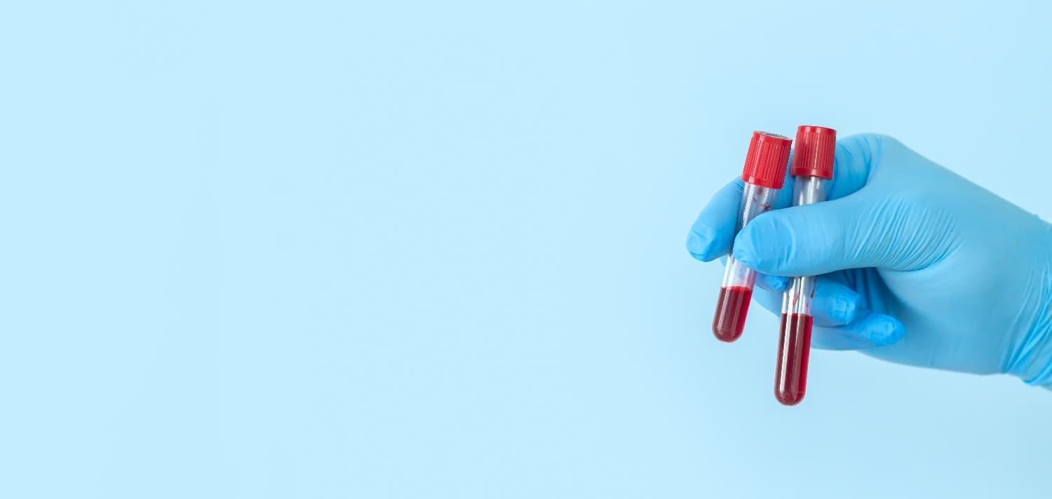 BLOOD BANK